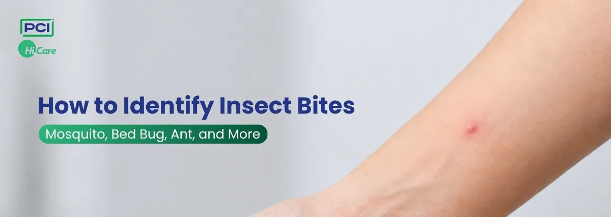How to Identify Insect Bites: Mosquito, Bed Bug, Ant, Cockroach, and More